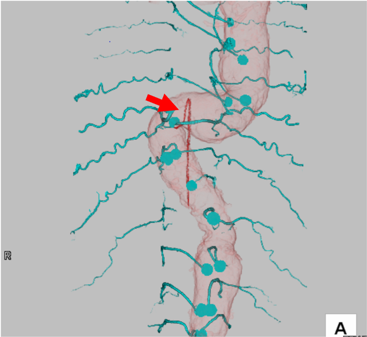 図3．VR像 図3．VR像