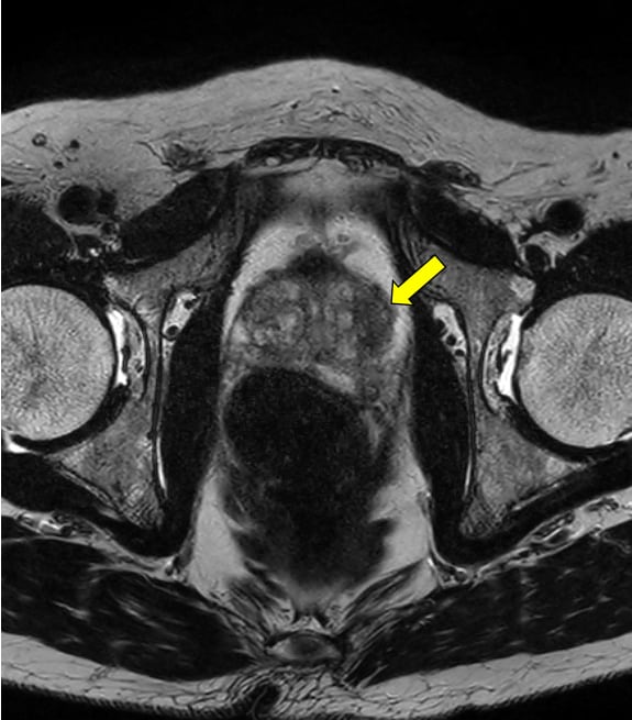 図1．T2強調画像