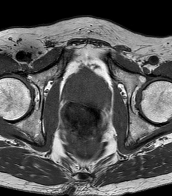 図2．T1強調画像