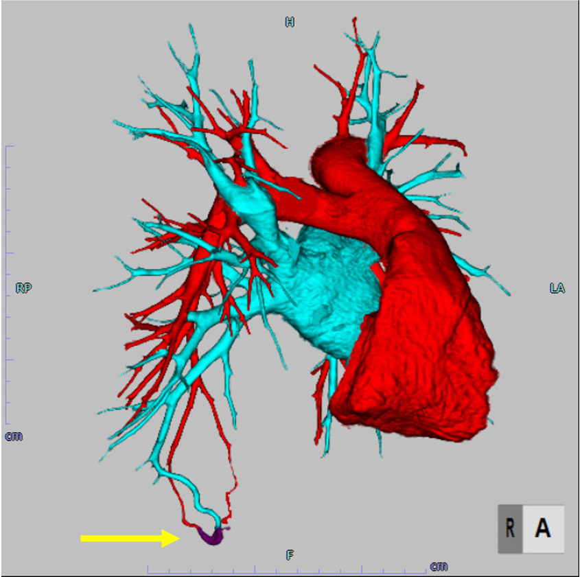 図2．3DCT Volume Rendering