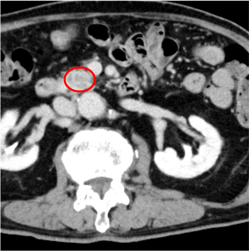 図3．平衡相(図1 と同一のレベル)
