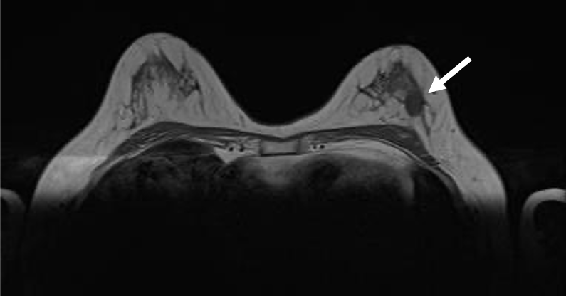 図1．T１強調像