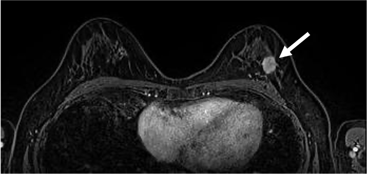図4．ダイナミックMRI 早期相
