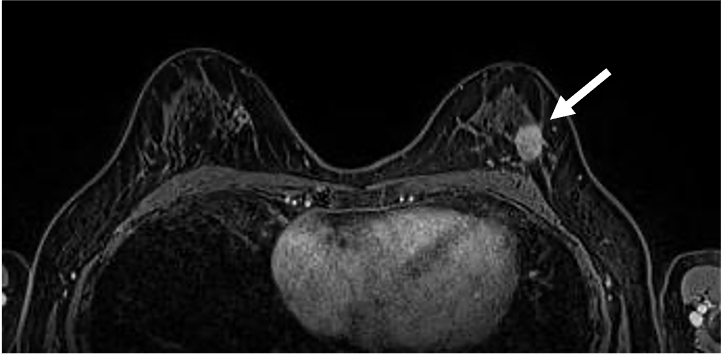 図5．ダイナミックMRI 遅延相