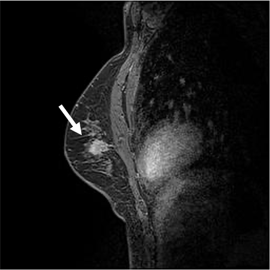 図6．造影後T１強調像