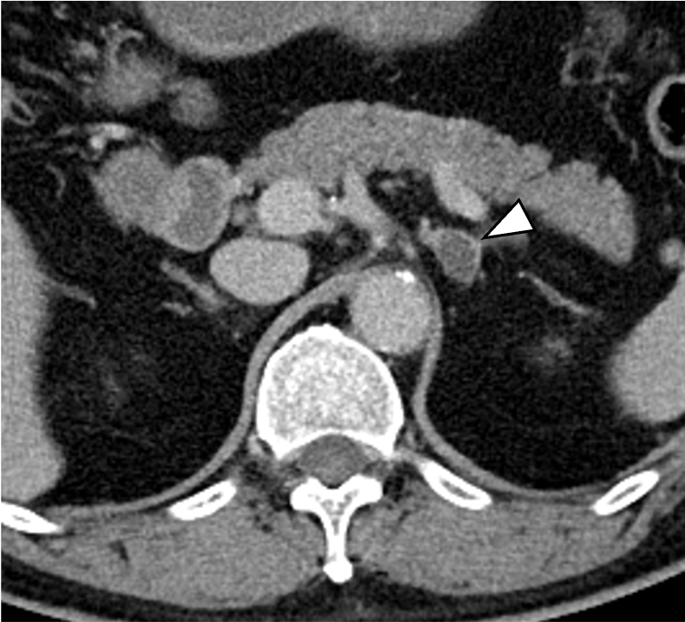 図１．平衡相　横断像