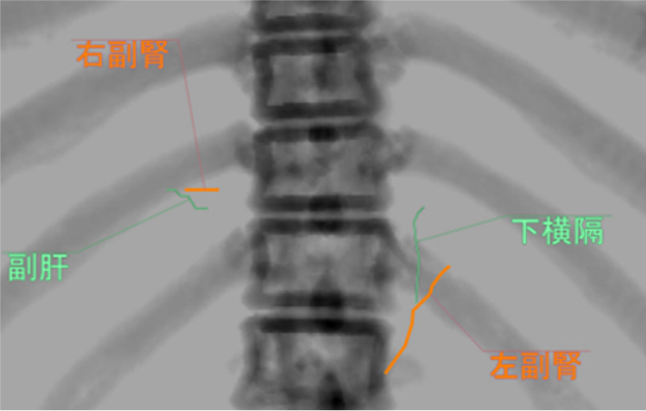 図5．仮想透視画像