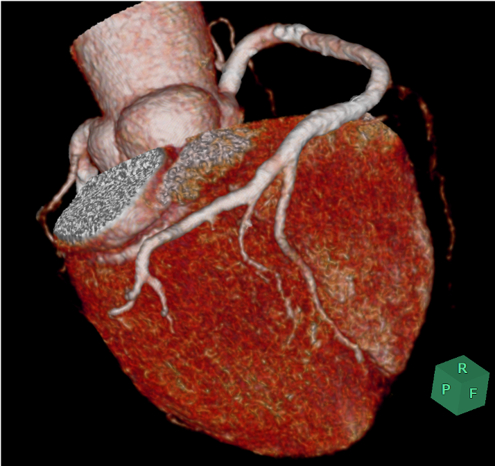 図１．volume rendering(VR)画像