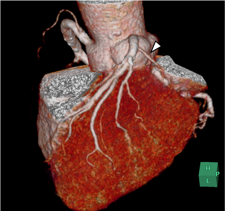 図2．volume rendering (VR)画像