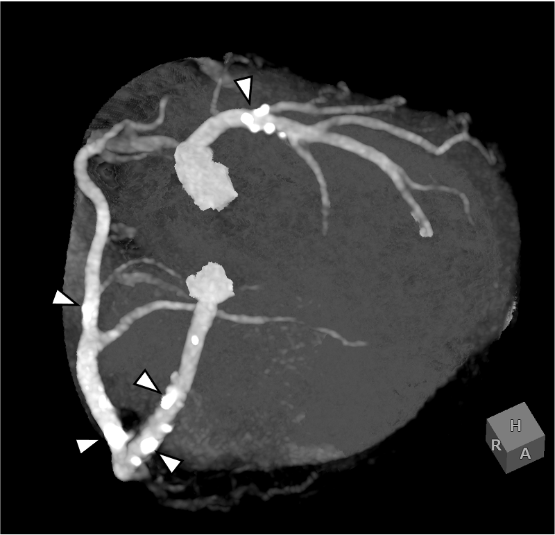 図3．angiographic view