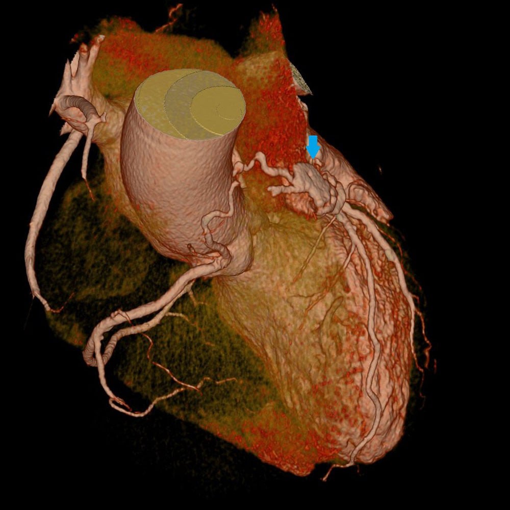 図１．心臓CT（VR)