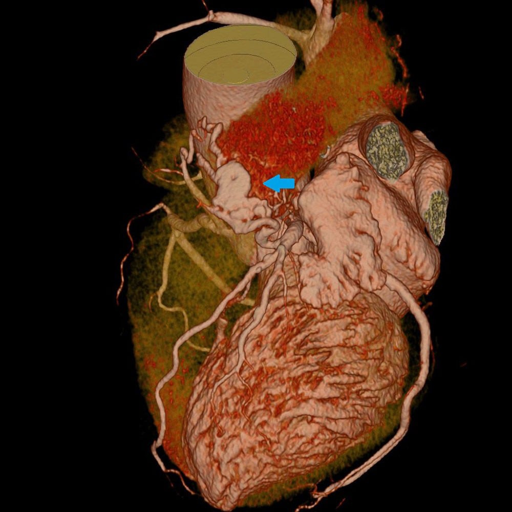 図2．心臓CT（VR)