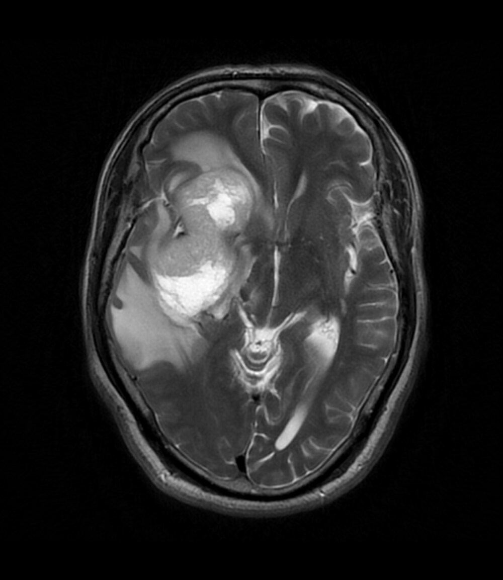 図1．T2強調画像