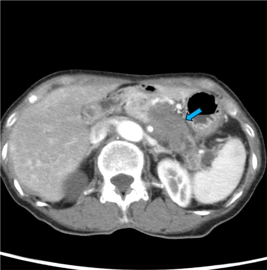 図１．後期動脈相