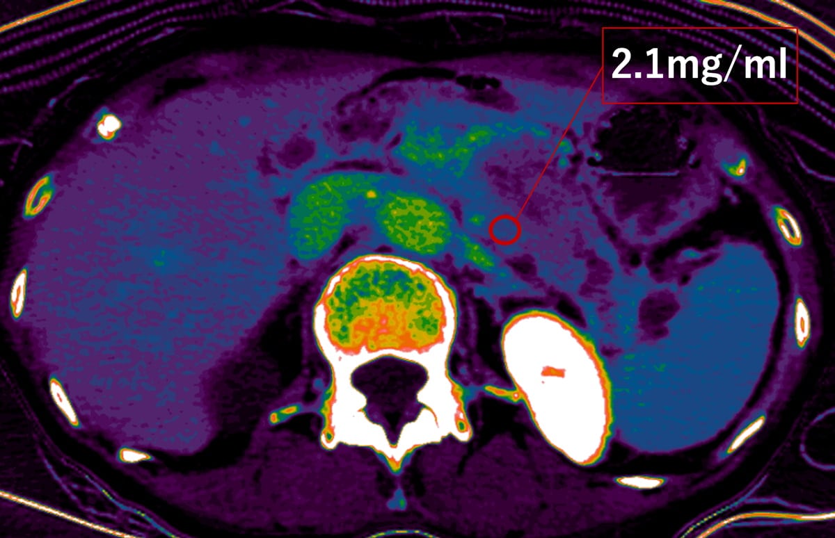 図4．平衡相 ヨード密度画像