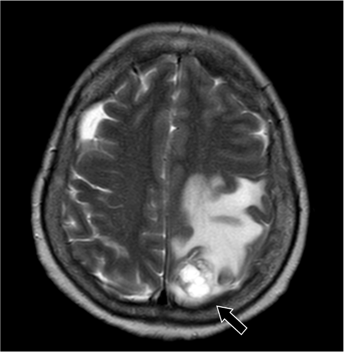 図1．T2強調画像