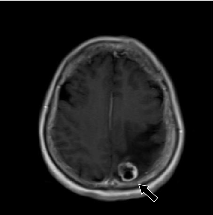 図5．造影T1強調画像