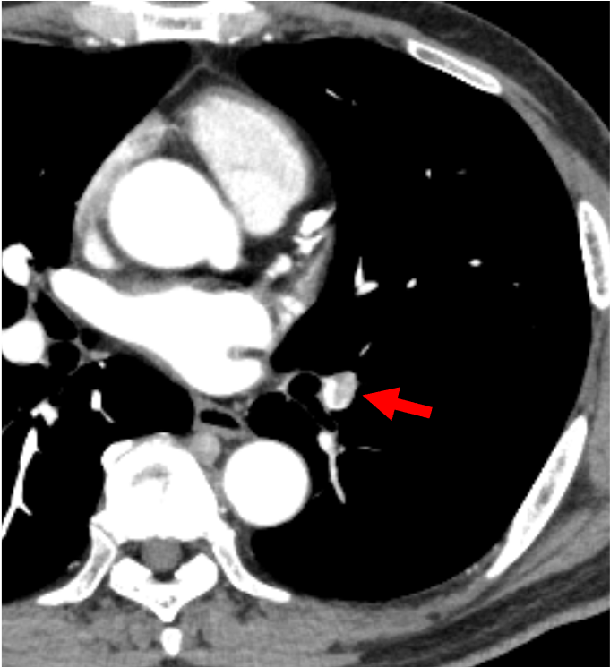 図3．動脈相（横断像）