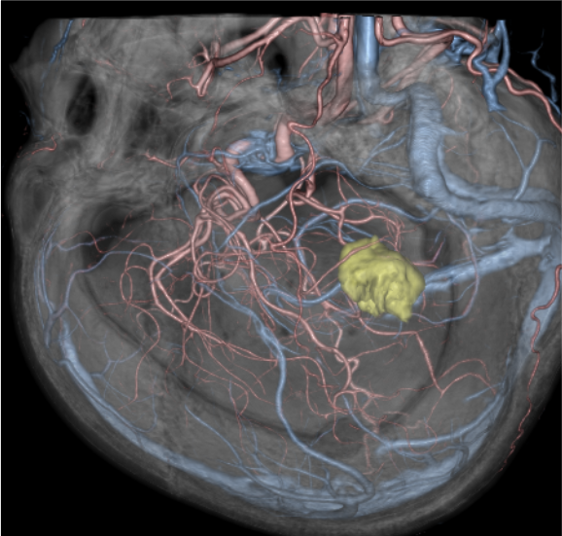 図5．手術支援画像