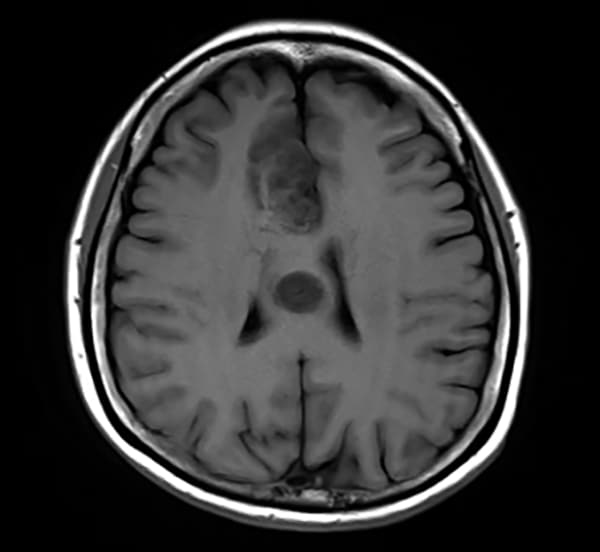図1．T1強調画像
