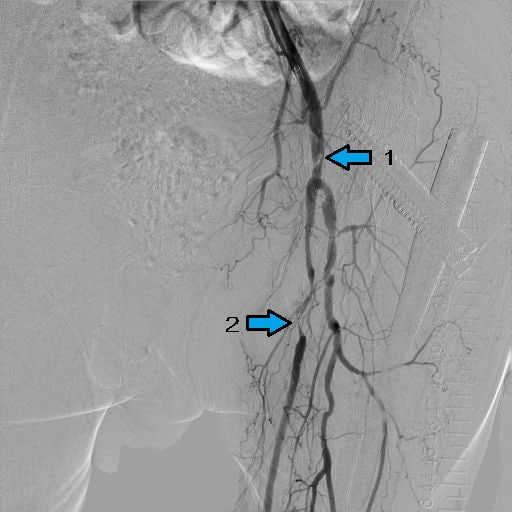 図3．SFA Pre画像