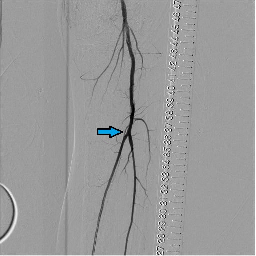 図10．BK Post画像