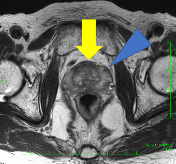 図１．T２強調画像