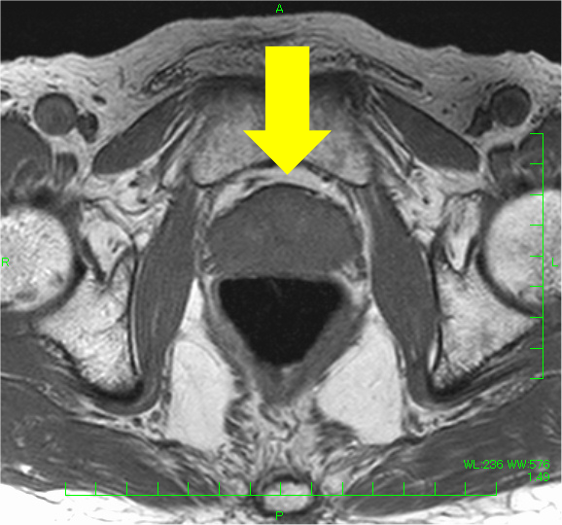 図4．T1強調画像