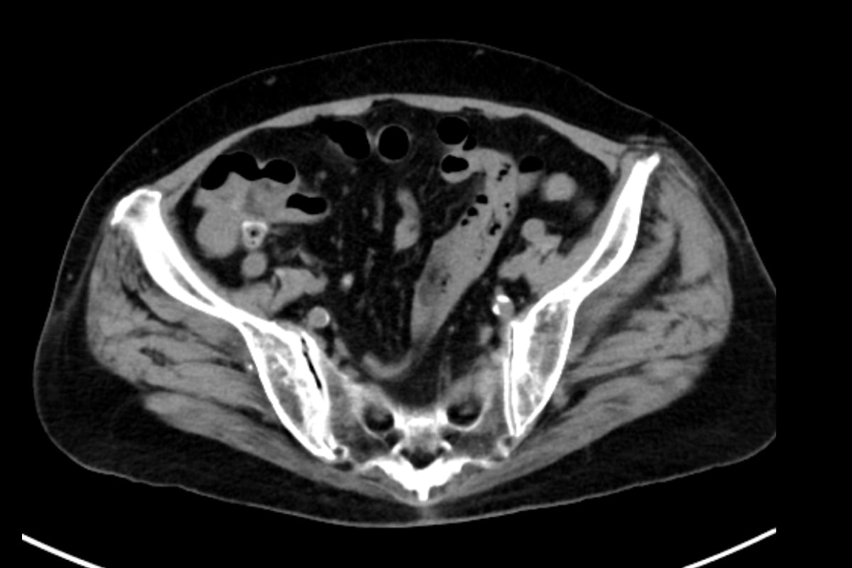 図１．横断像、単純