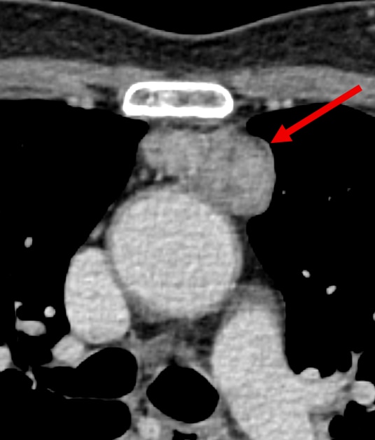 図１．造影動脈相