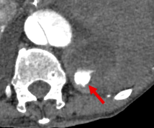 図2．造影早期相