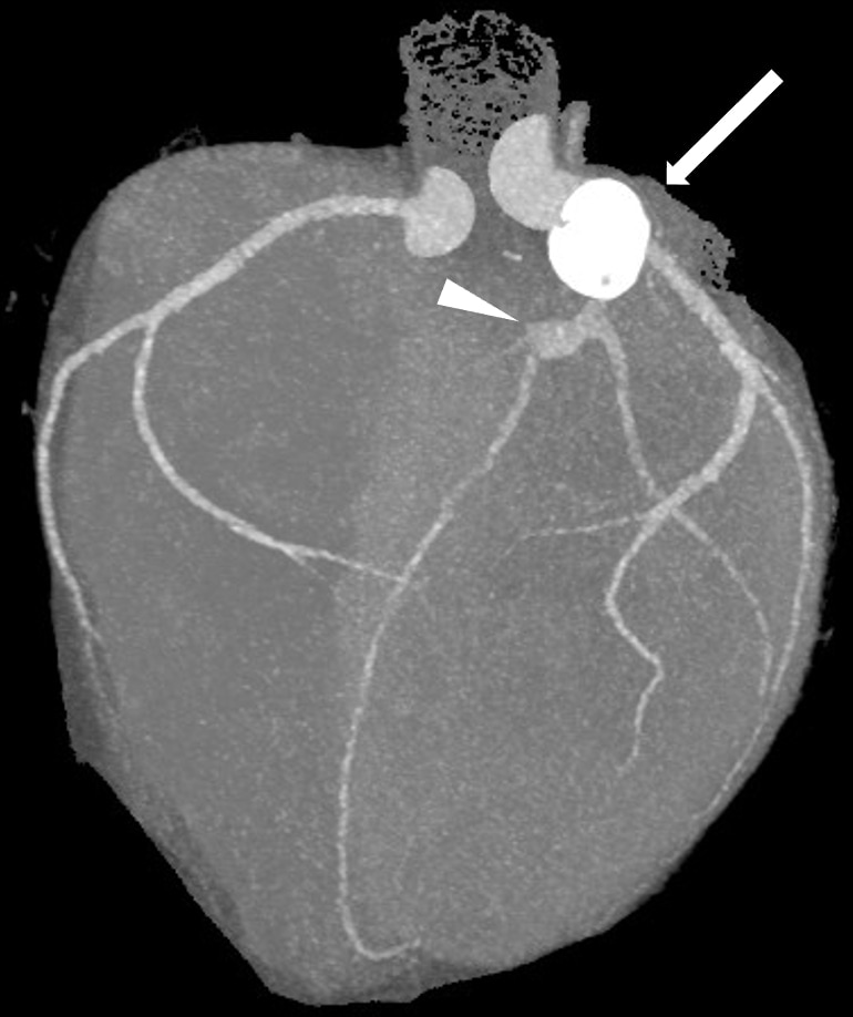 図2．Angiographic View