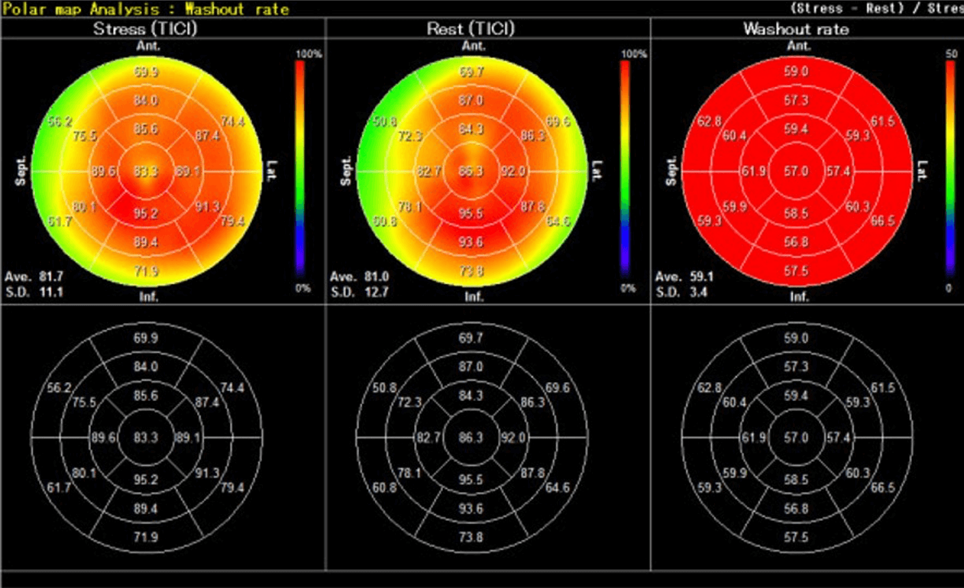 図4．201 Tl心筋血流シンチグラフィー