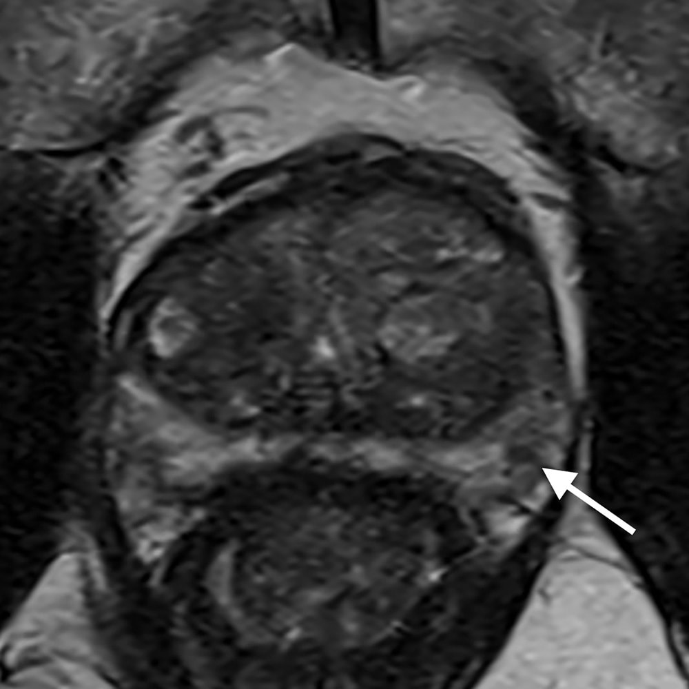 図4．T2強調画像
