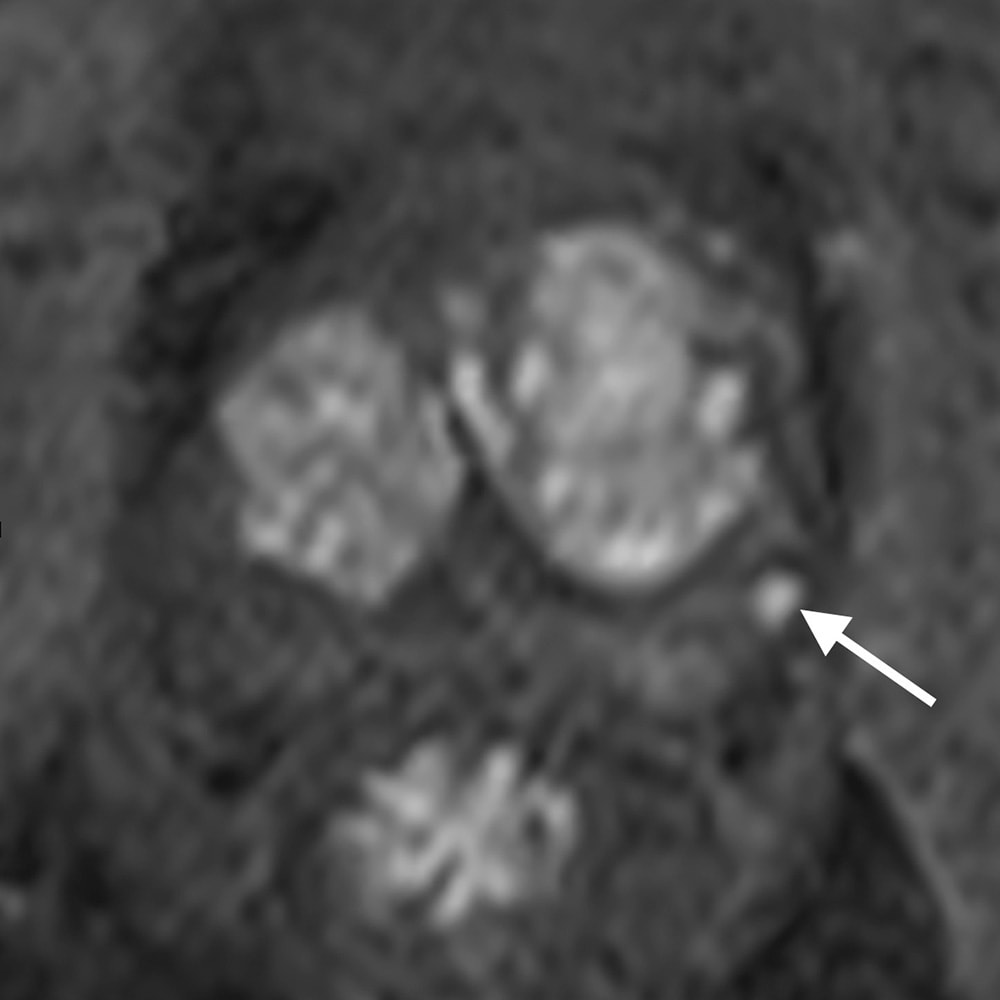 図5．造影ダイナミック早期相