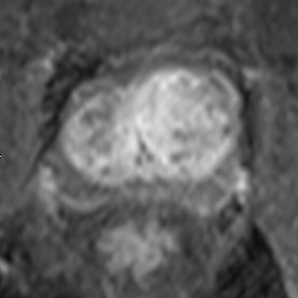 図6．造影ダイナミック遅延相