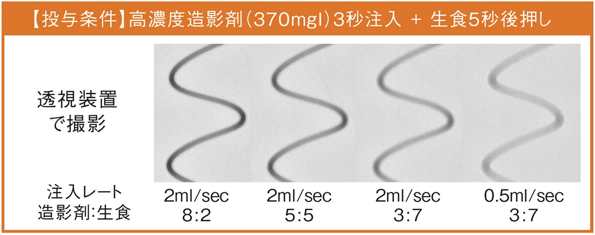 均一に造影されたチューブ内の様子（同時注入時） 