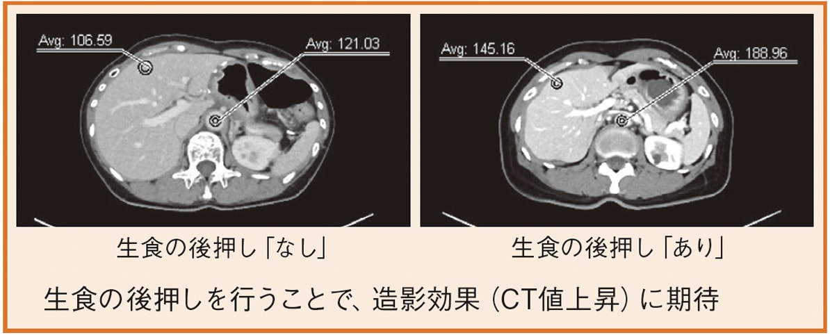 生食の後押し効果（肝実質、大動脈のCT値（HU））