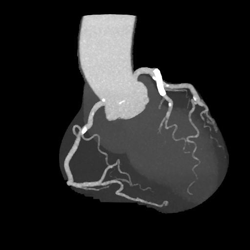 図3．アンギオグラフィックビュー
