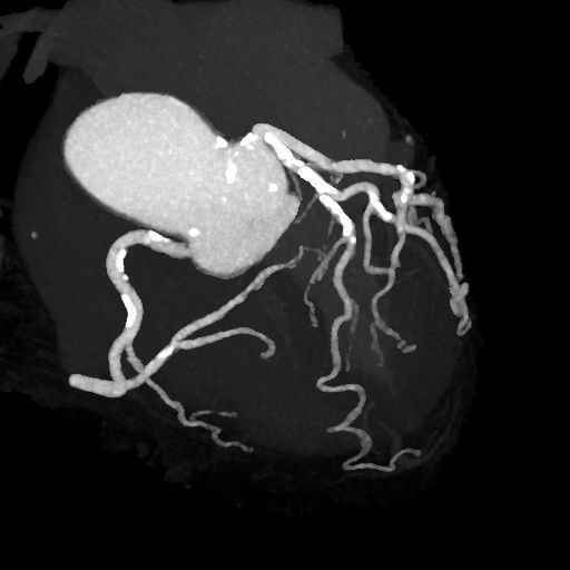 図3．アンギオグラフィックビュー