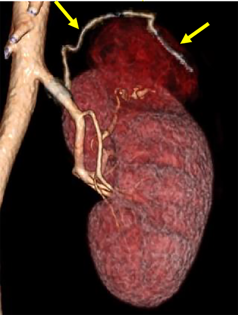 図4．volume rendering(VR)画像