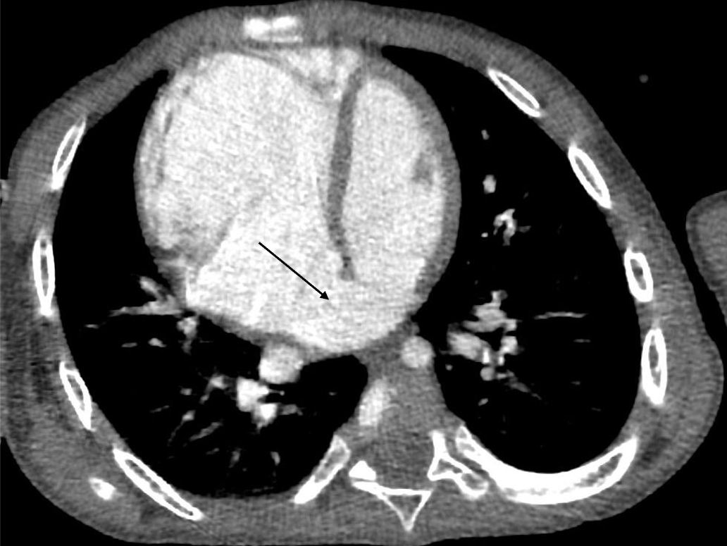 図1．造影CT軸位断像