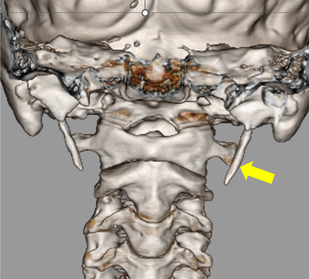 図4．頭頸部VR像