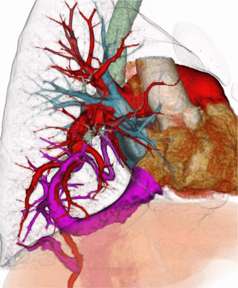 図3．3次元再構成VR像