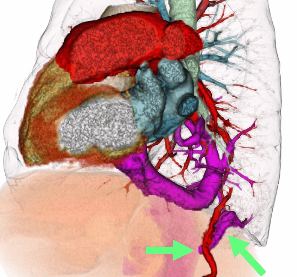 図4．3次元再構成VR像