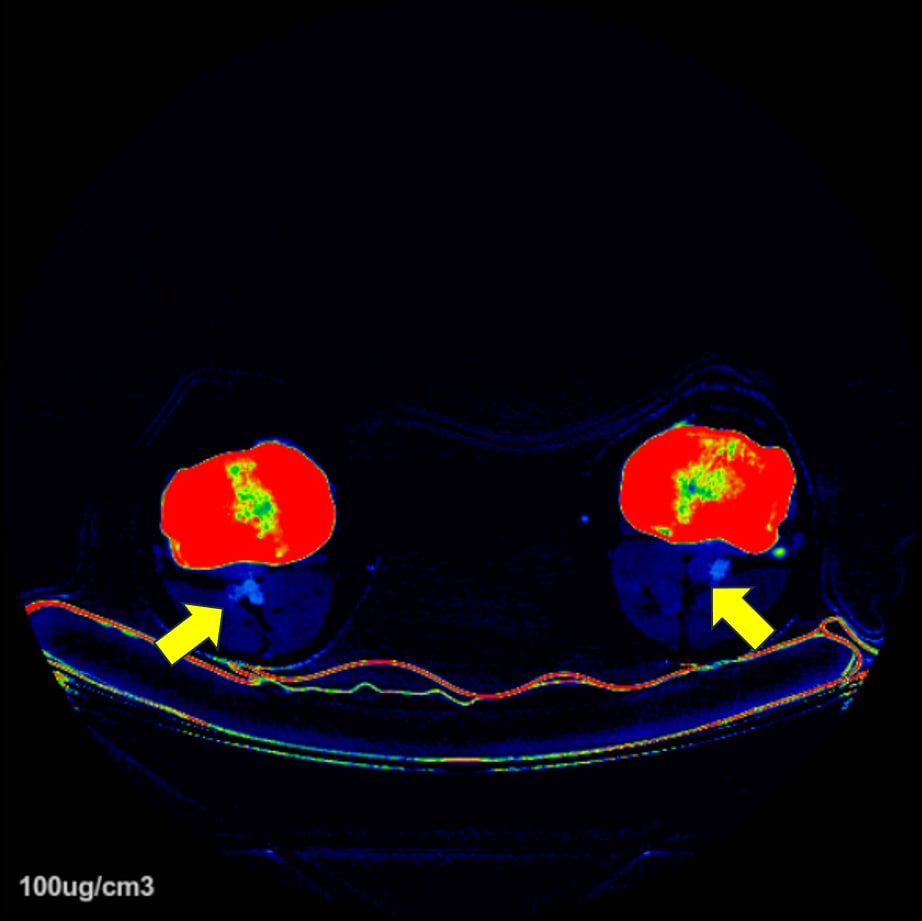 図6．ヨードマップ