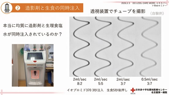 図6 同時注入時のチューブ内の様子(自験例)