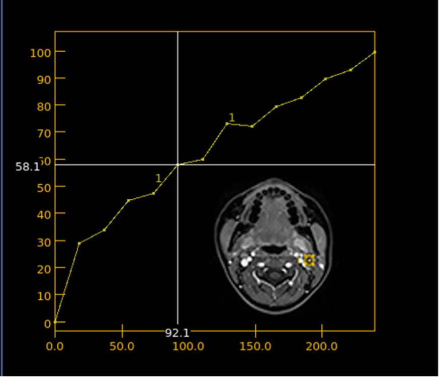 図6．TIC: time intensity curve